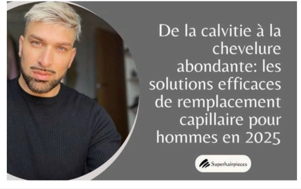 remplacement capillaire pour hommes en 2025
